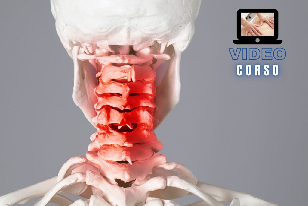 Jones Strain Counterstrain disfunzioni del rachide cervicale video corso